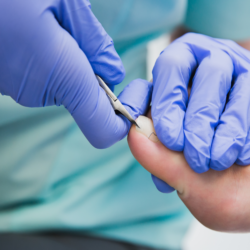 Pedicure podologiczny w gabinecie Vigipodia